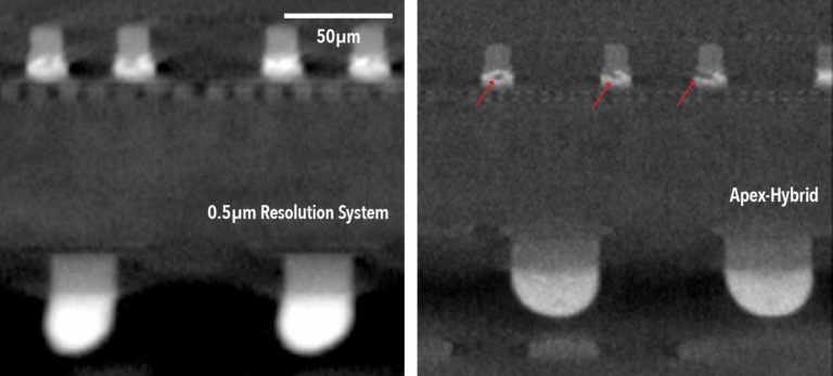 Apex-Hybrid 3D X-Ray System
